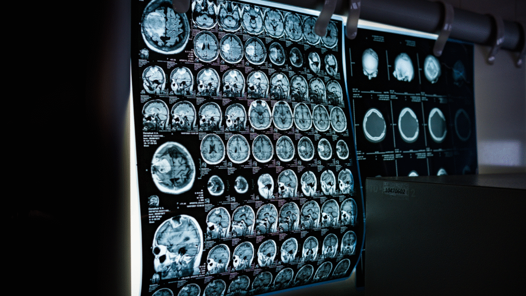 Brain Scan Interpretation, AI in Healthcare